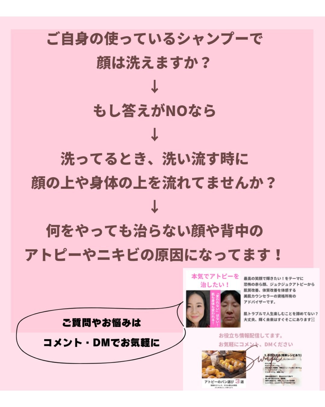 美肌カウンセラー💆肌悩みを解決し見る世界を変える on LIPS 「今、お風呂で使ったシャンプーそれで顔も洗える?えっ?洗えない…..」(2枚目)