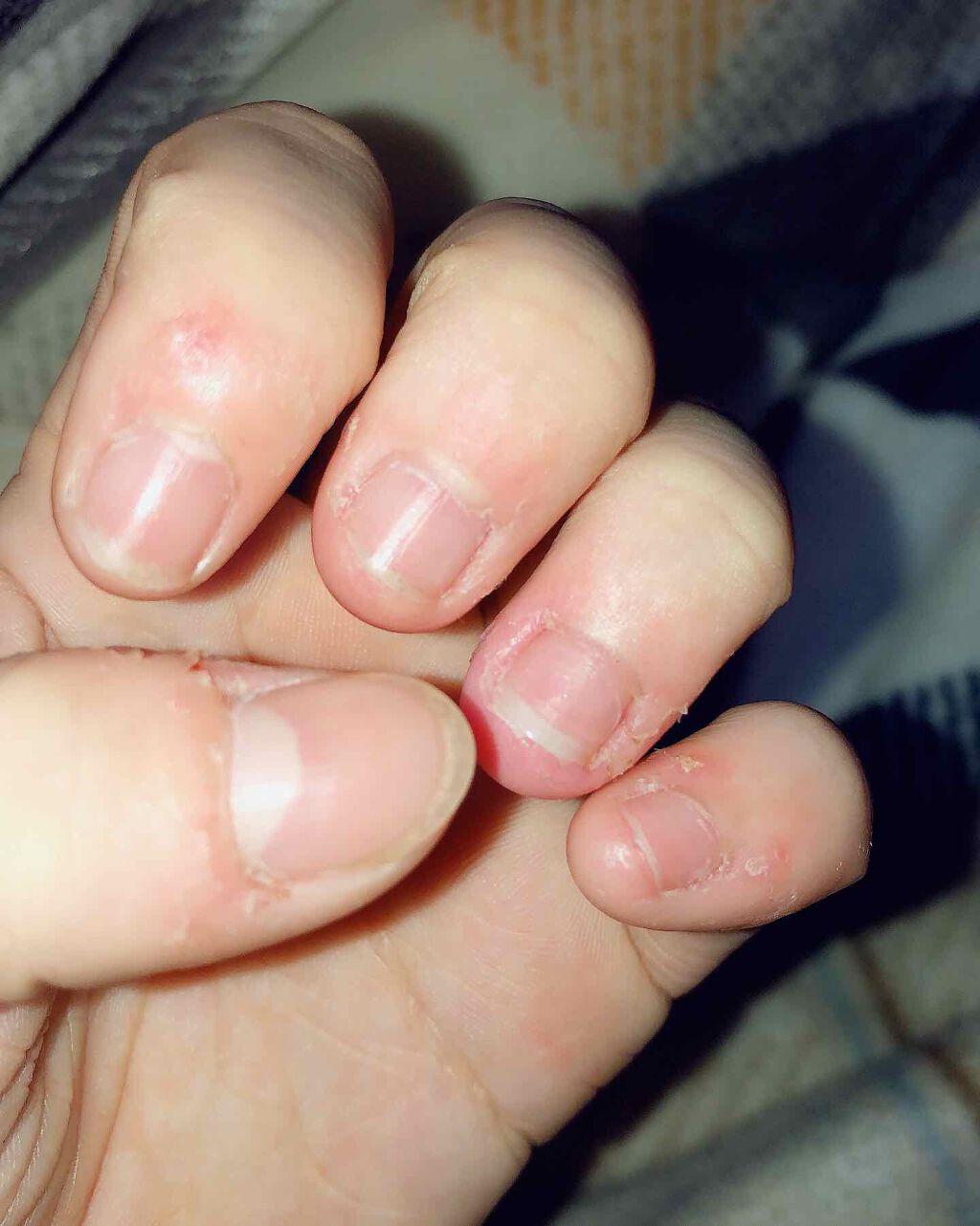 カラフルネイルズ ネイルハードナー/キャンメイク/ネイルトップコートを使ったクチコミ(2枚目)