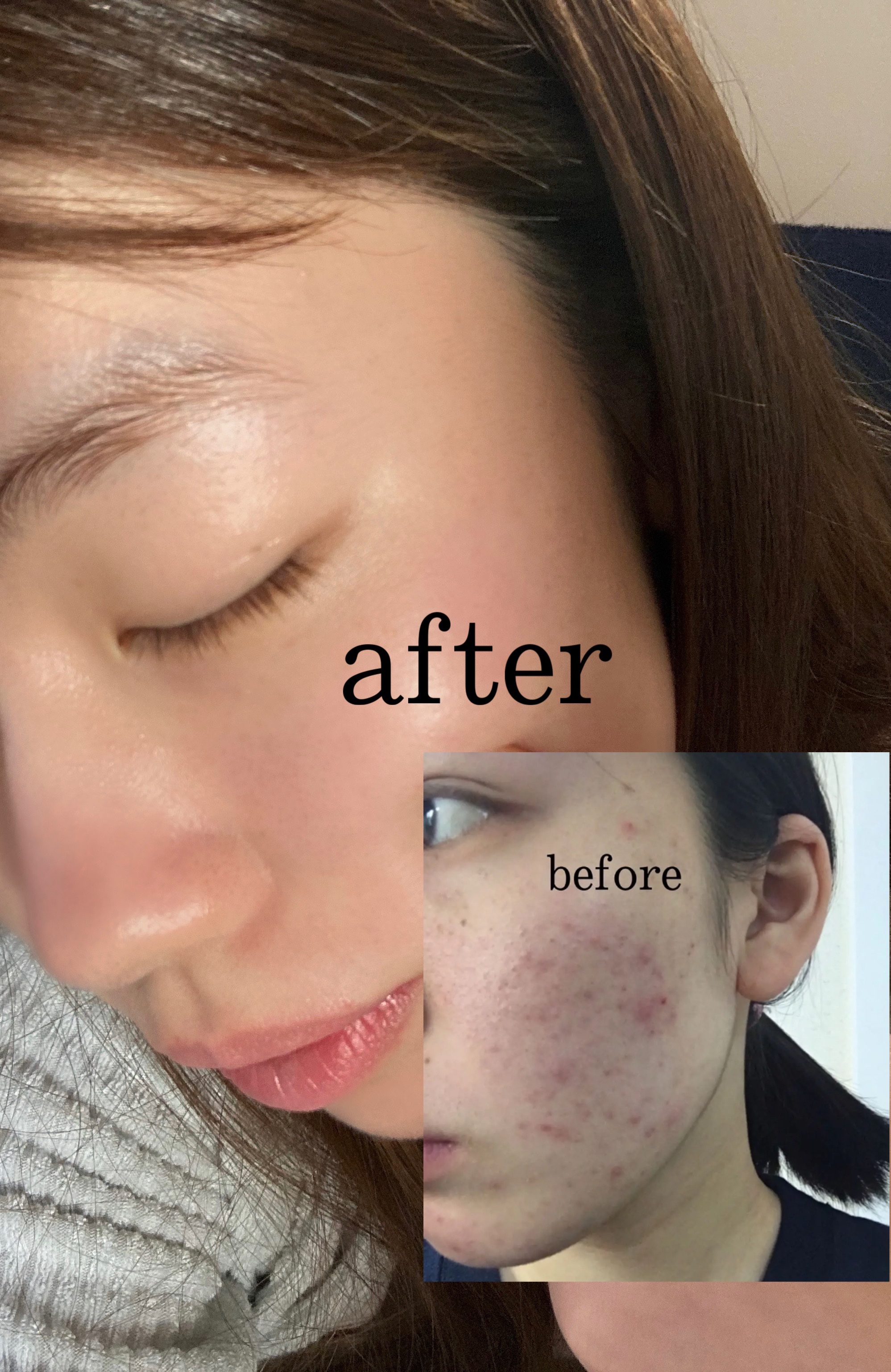 アルジェラン オーガニック 艶肌クレンジングオイル/アルジェラン/オイルクレンジングを使ったクチコミ（1枚目）