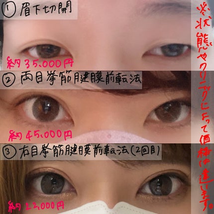 Fabulous(ファビュラス)1month GLASS BROWN(グラスブラウン)/FABUROUS/カラーコンタクトレンズの画像