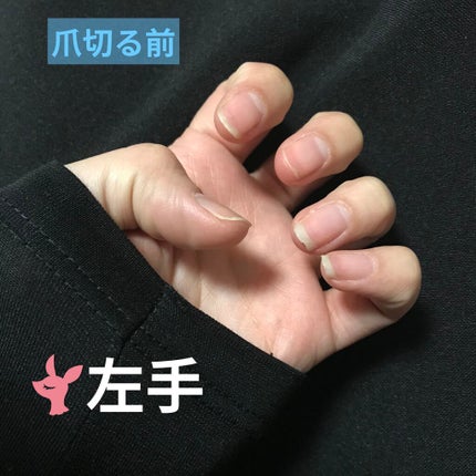 d プログラム バランスケア ローション MBのクチコミ「こんにちは!
こげたぱんです🍞
今回の投稿も #爪日記 です。
自身の記録用でもありま.....」(1枚目)