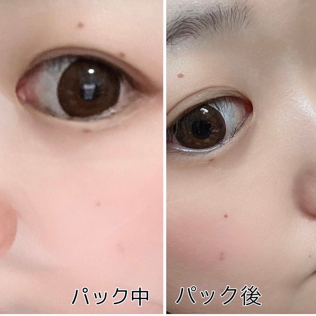 シカーミング30daysマスク/One-day's you/シートマスク・パックを使ったクチコミ(4枚目)