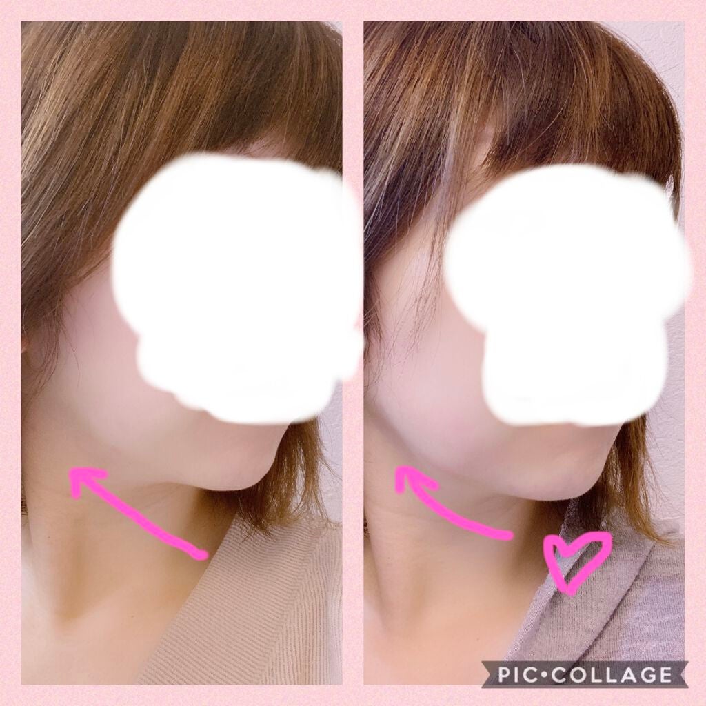 NICOBELT(ニコベルト)/VONMIE/美顔器・マッサージを使ったクチコミ(2枚目)