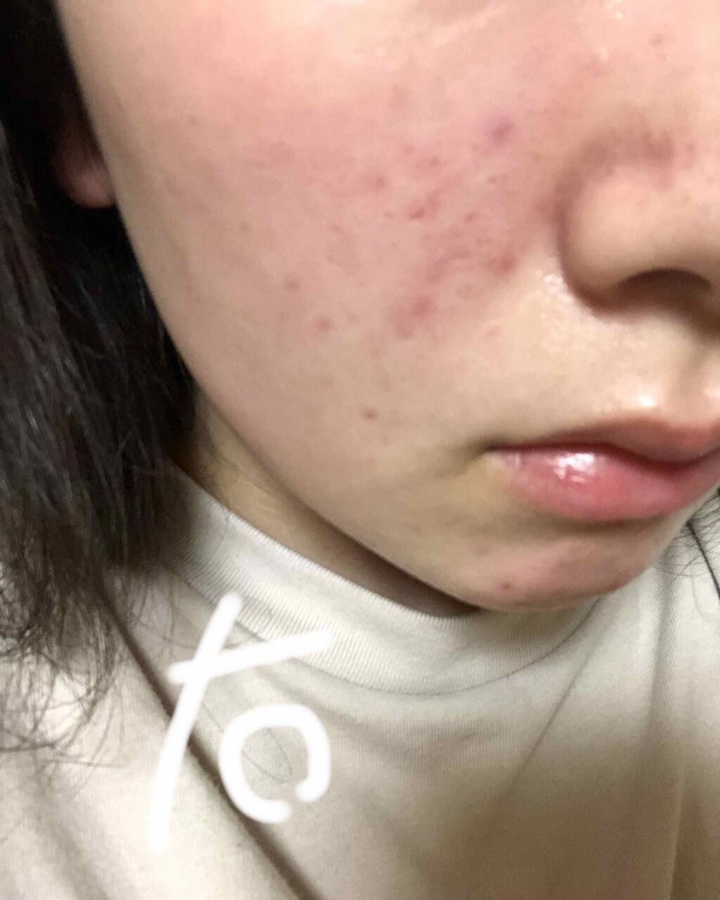 ハトムギ保湿ジェル(ナチュリエ スキンコンディショニングジェル)/ナチュリエ/美容液を使ったクチコミ（3枚目）