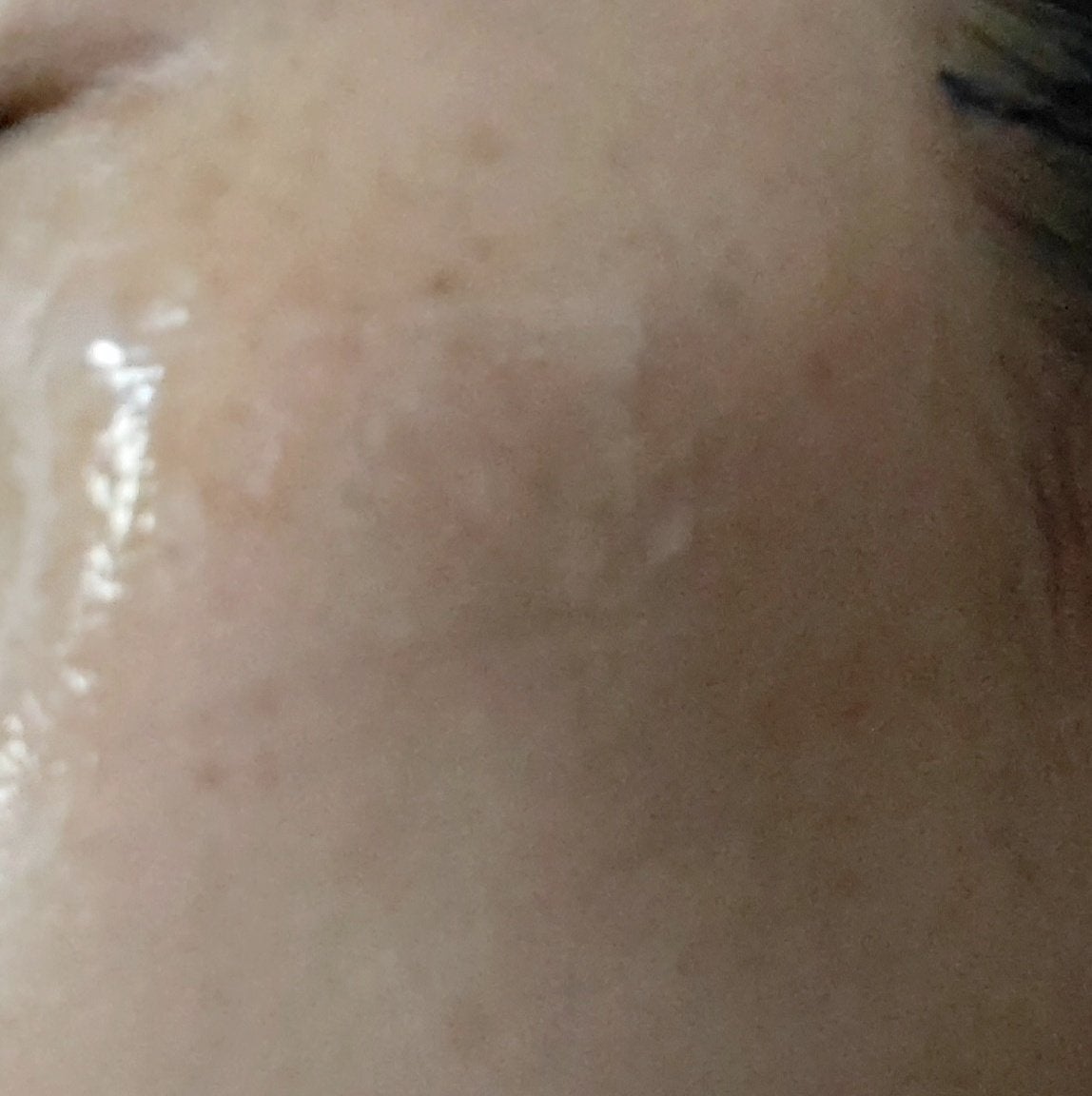 ディーププラスAZ/Macchia Label/美容液を使ったクチコミ(6枚目)