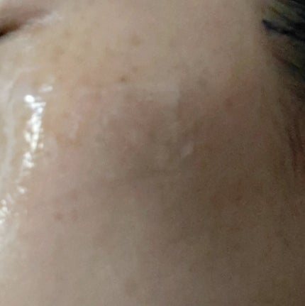 ディーププラスAZ/Macchia Label/美容液を使ったクチコミ(6枚目)