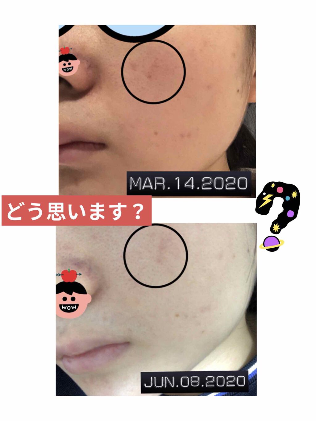 薬用 しみ 集中対策 美容液/メラノCC/美容液を使ったクチコミ(3枚目)