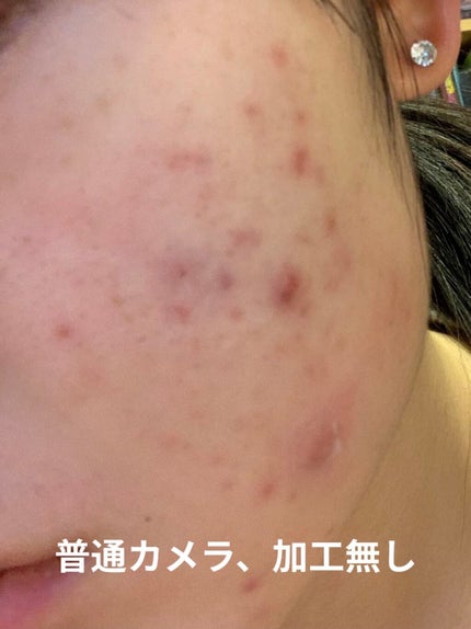白色ワセリン(医薬品)/健栄製薬/その他を使ったクチコミ(3枚目)