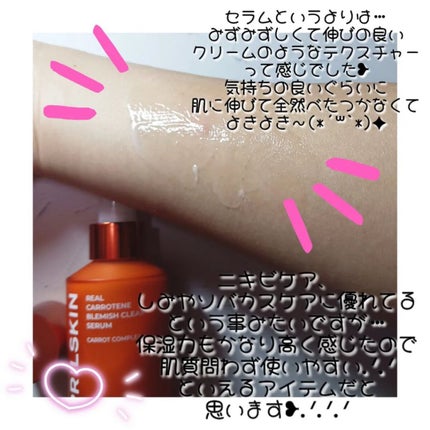 リアルカロテンブレミッシュクリアセラム/APRILSKIN/美容液を使ったクチコミ(4枚目)