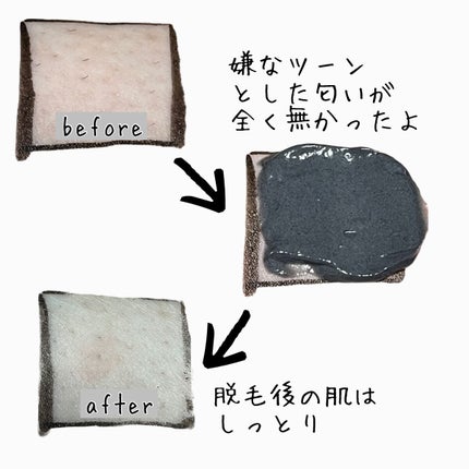 薬用ブラックリムーバー/RODOMIS/除毛クリームを使ったクチコミ(3枚目)