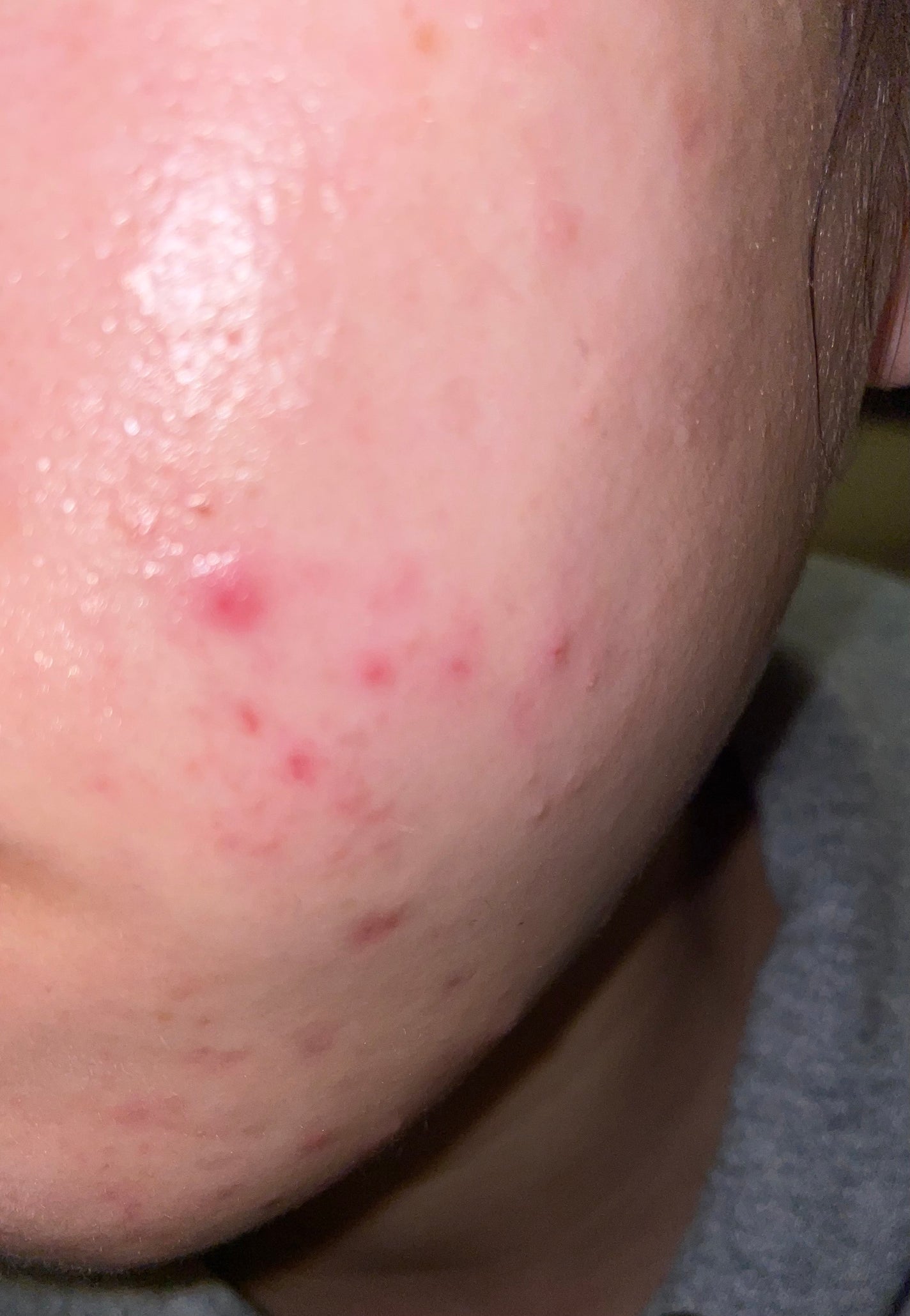 ãµãð°ð€ on LIPS ããã®ãããèãšæ¯ç©Žã§æ©ãã§ããŸããã©ããªããšã§ãè¯ãã®ã§ãæ¹å..ãïŒ1æç®ïŒ