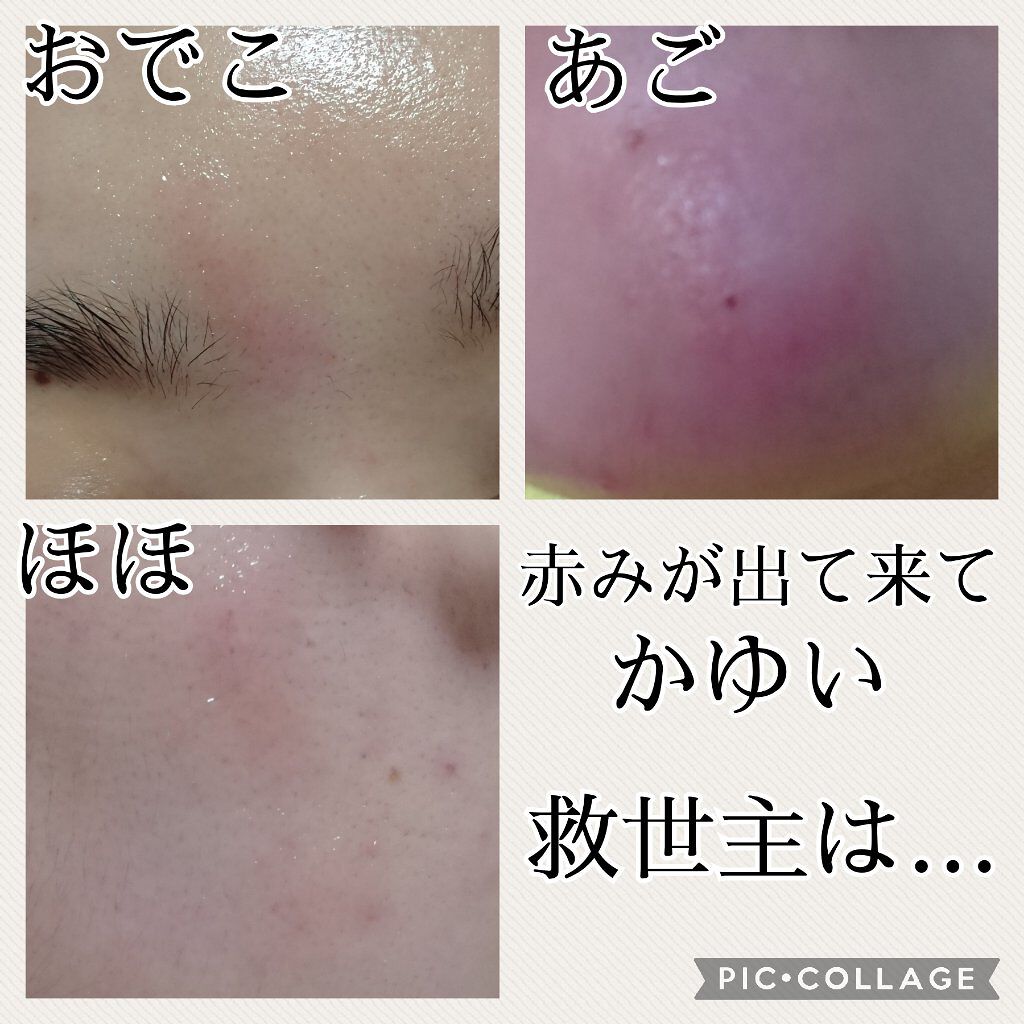 ピュアベール(医薬品)/プロペト/その他を使ったクチコミ（1枚目）