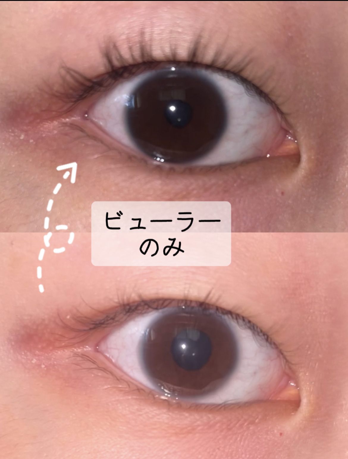 ひとえ・奥ぶたえ用カーラー/アイプチ®/ビューラーを使ったクチコミ（2枚目）