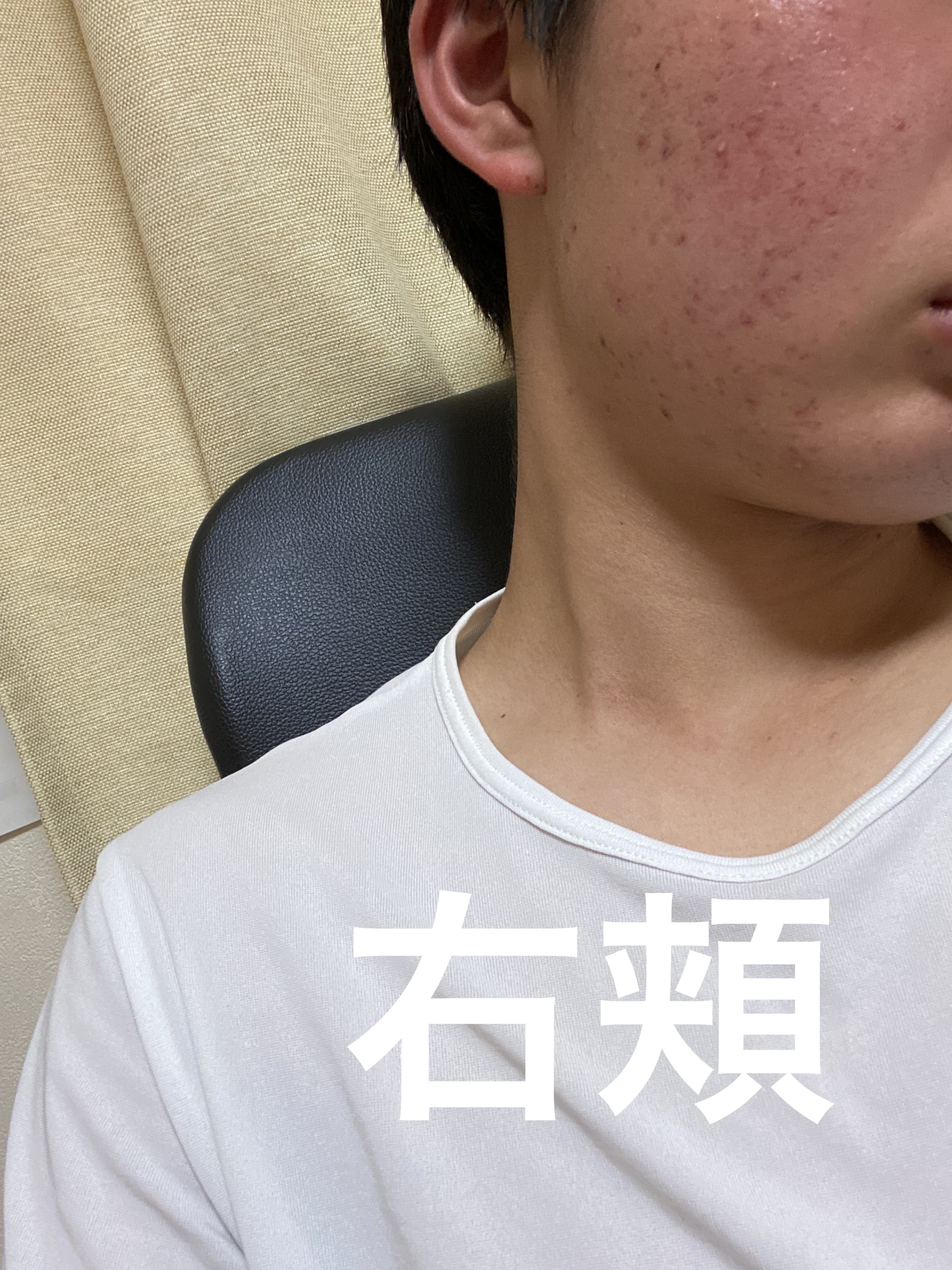 レチノショット 0.1/TOUT VERT/フェイスクリームを使ったクチコミ（3枚目）