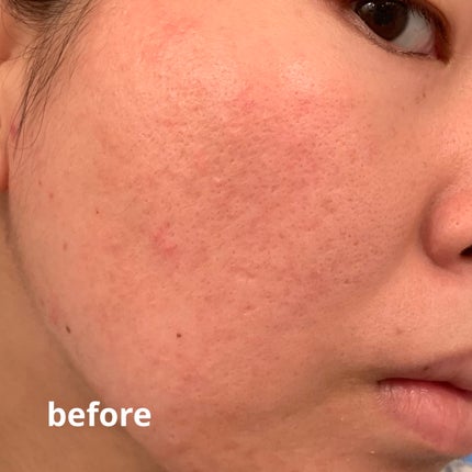 ネオクッション マット/LANEIGE/クッションファンデーションを使ったクチコミ(7枚目)