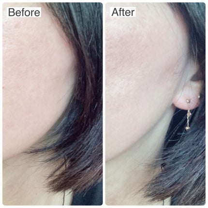 うにこ on LIPS 「株式会社AnelaのAAAA.リキッドファンデーションを使いま..」(5枚目)