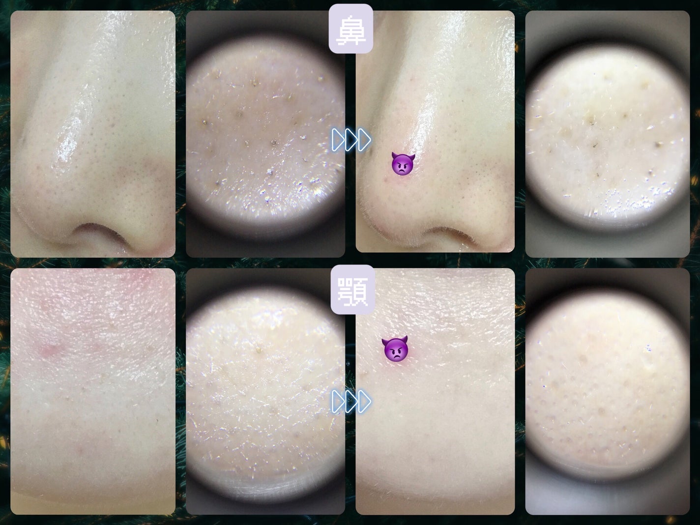 CICA デイリースージングマスク/VT/シートマスク・パックを使ったクチコミ(5枚目)