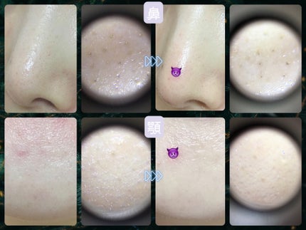 CICA デイリースージングマスク/VT/シートマスク・パックを使ったクチコミ(5枚目)