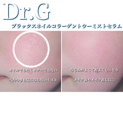 ドクタージー ブラックスネイル コラーゲンミスト/Dr.G/ミスト状化粧水を使ったクチコミ(4枚目)
