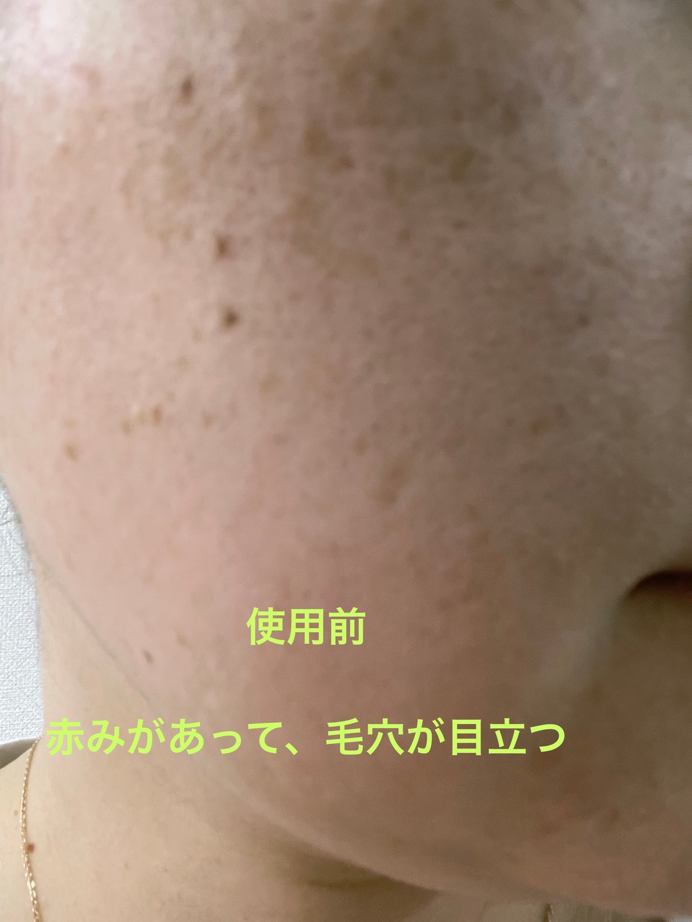 バイオ コンディショニング エッセンス/IOPE/ブースター・導入液を使ったクチコミ(4枚目)