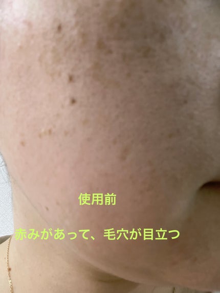 バイオ コンディショニング エッセンス/IOPE/ブースター・導入液を使ったクチコミ(4枚目)