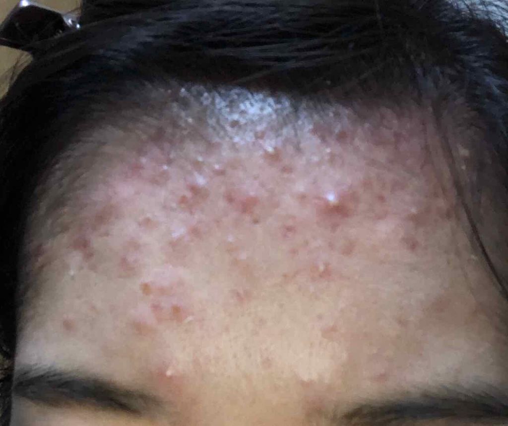 ハトムギ化粧水(ナチュリエ スキンコンディショナー R )/ナチュリエ/化粧水を使ったクチコミ（2枚目）