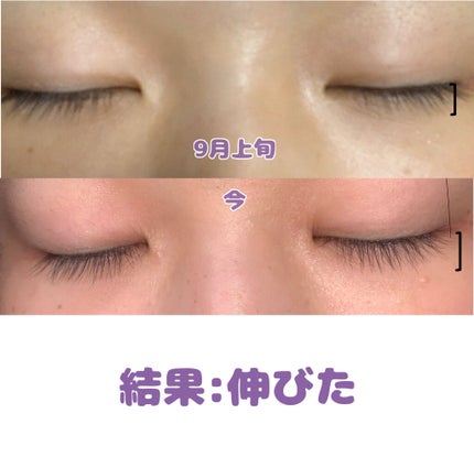 スカルプD ボーテ ピュアフリーアイラッシュセラム プレミアム/アンファー(スカルプD)/まつげ美容液を使ったクチコミ(2枚目)