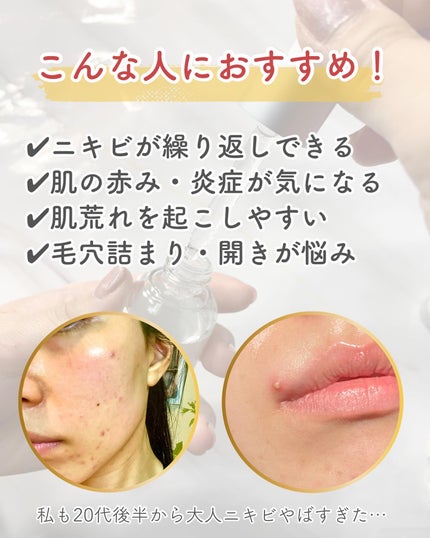 131 ポア クリアリング セラム/Celladix/美容液を使ったクチコミ(5枚目)