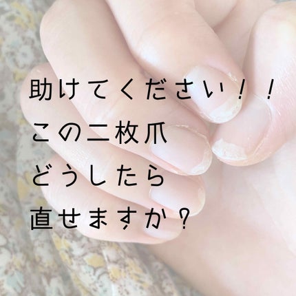 グロッシーコート/スキューズミー/オールインワンネイルを使ったクチコミ(1枚目)
