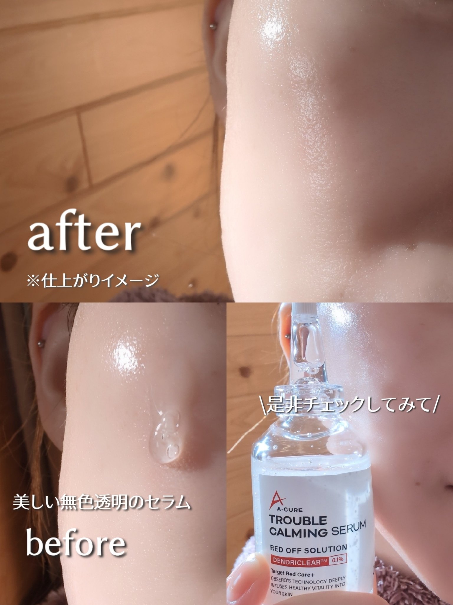 エーキュアトラブルカーミングセラム/obsero/美容液を使ったクチコミ（3枚目）