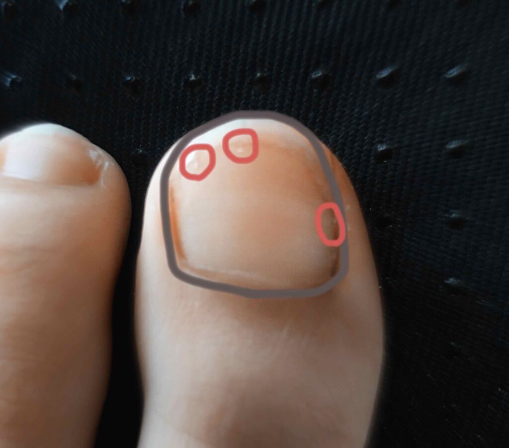 サンリオネイル/DAISO/マニキュアを使ったクチコミ(4枚目)