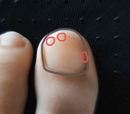 サンリオネイル/DAISO/マニキュアを使ったクチコミ(4枚目)