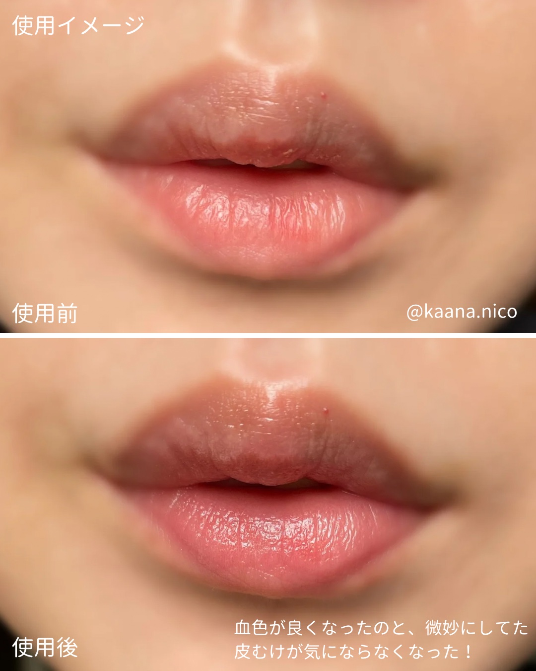 メンソレータム リペアワン 角質ケアリップ/メンソレータム/リップクリームを使ったクチコミ（3枚目）