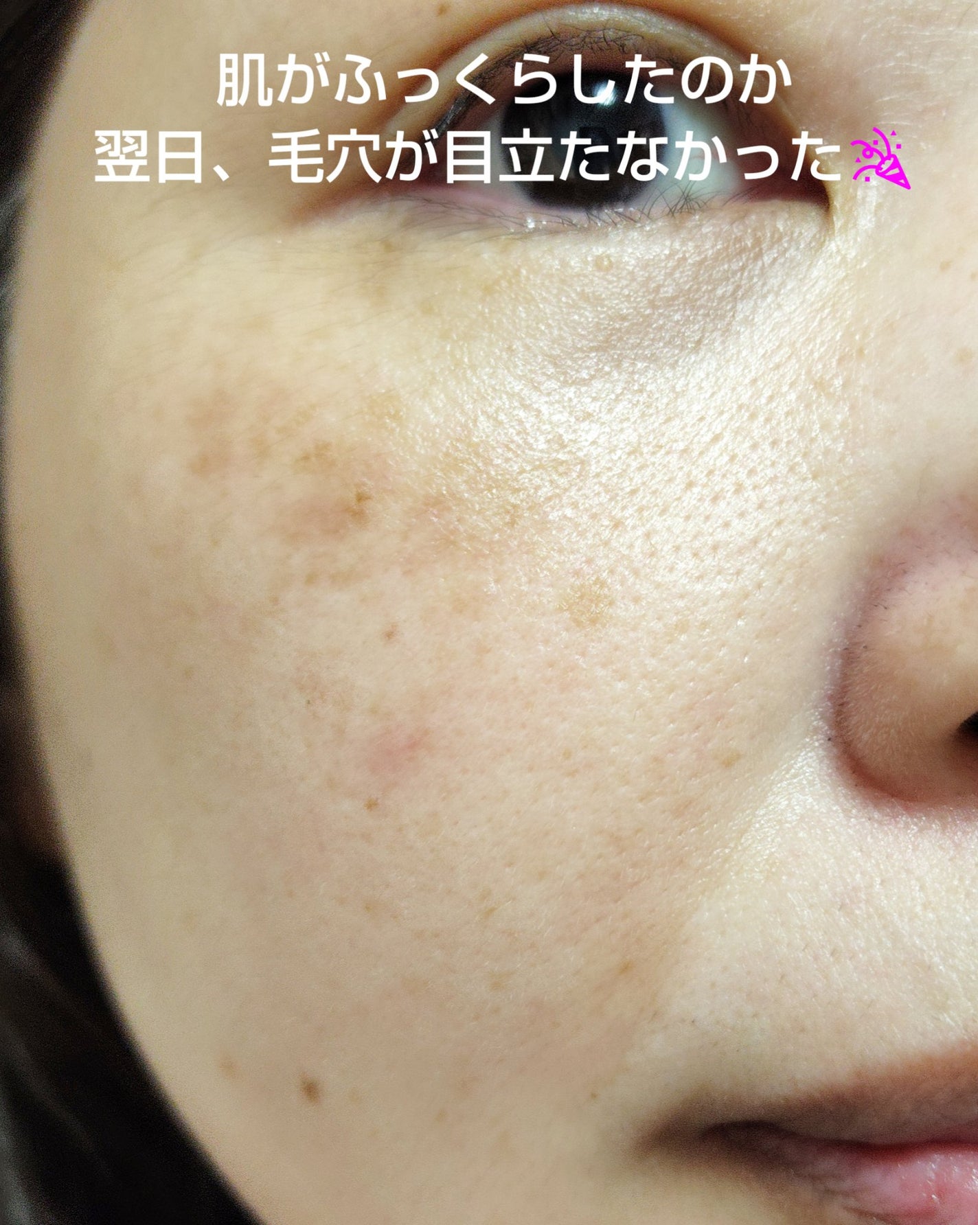 THE N.M.F APマスクJEX/MEDIHEAL/シートマスク・パックを使ったクチコミ(6枚目)