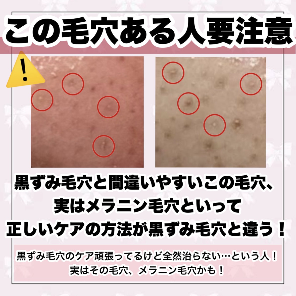 クレンジングリサーチ ウォッシュクレンジング N/クレンジングリサーチ/洗顔フォームを使ったクチコミ（3枚目）