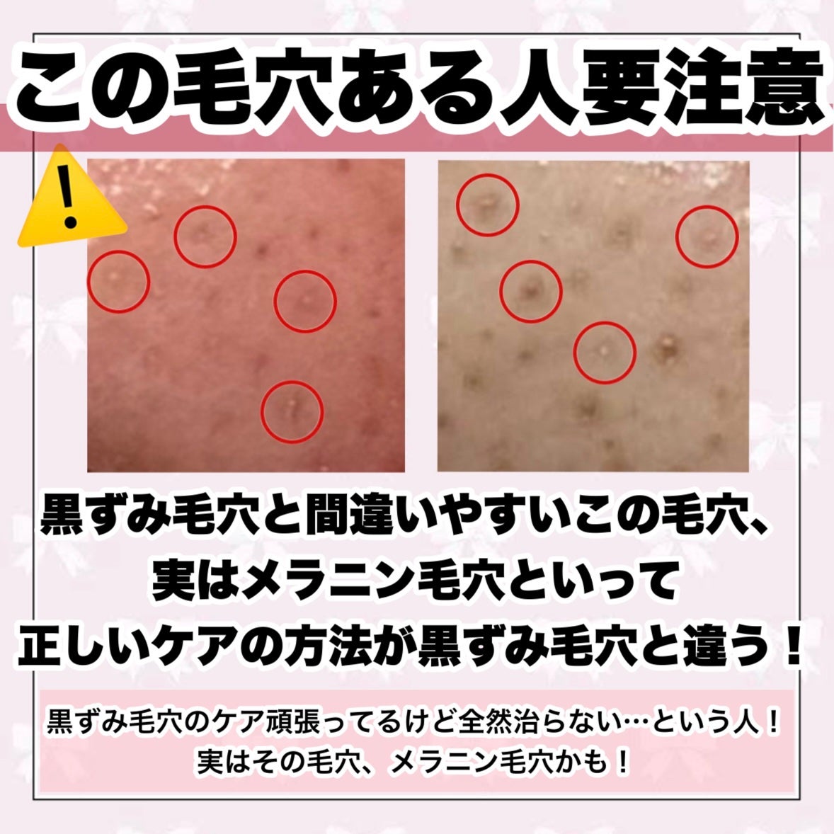 クレンジングリサーチ ウォッシュクレンジング N/クレンジングリサーチ/洗顔フォームを使ったクチコミ(3枚目)