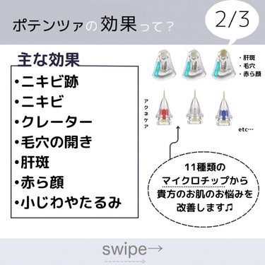 うやうやちゃん on LIPS 「初めての美容医療/POTENNZAってなあに🥺❔───────..」（3枚目）