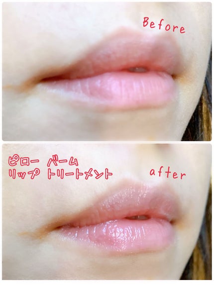 ~トゥー フェイスド ハングオーバー~ ピロー バーム リップ トリートメント/Too Faced/リップ美容液を使ったクチコミ(4枚目)