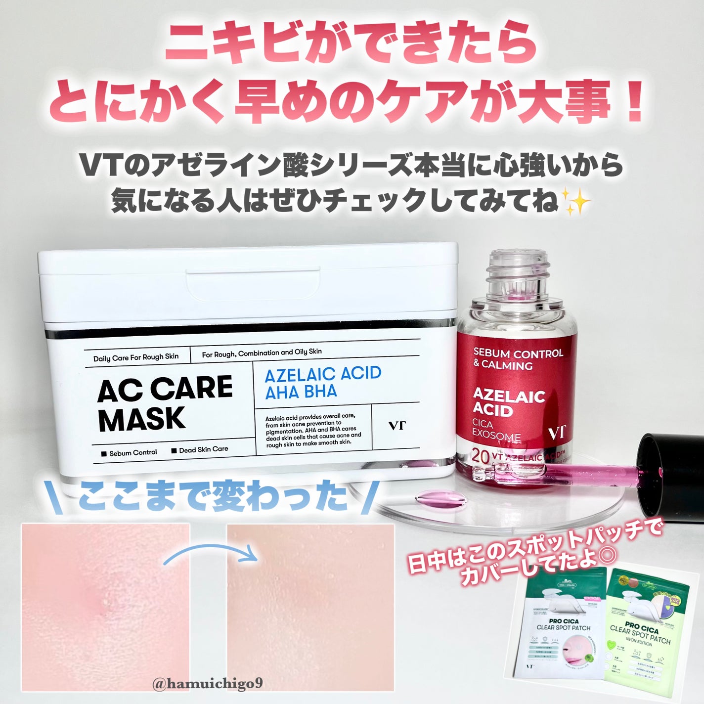 プロCICA クリアスポットパッチ/VT/その他スキンケアを使ったクチコミ(8枚目)
