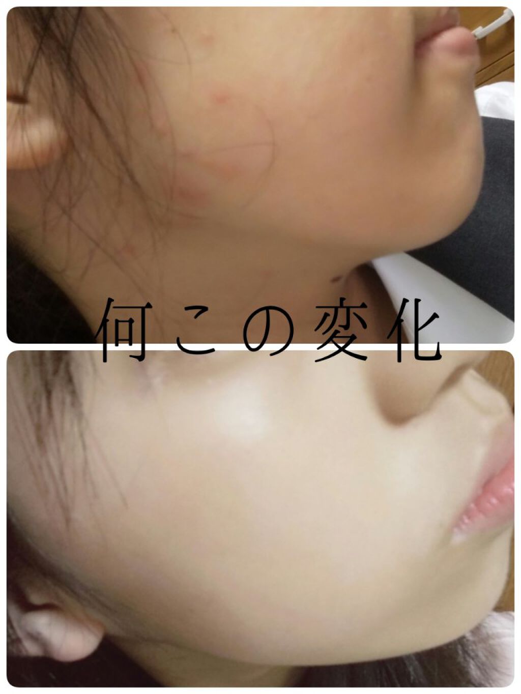 ハトムギ保湿ジェル(ナチュリエ スキンコンディショニングジェル)/ナチュリエ/美容液を使ったクチコミ（1枚目）