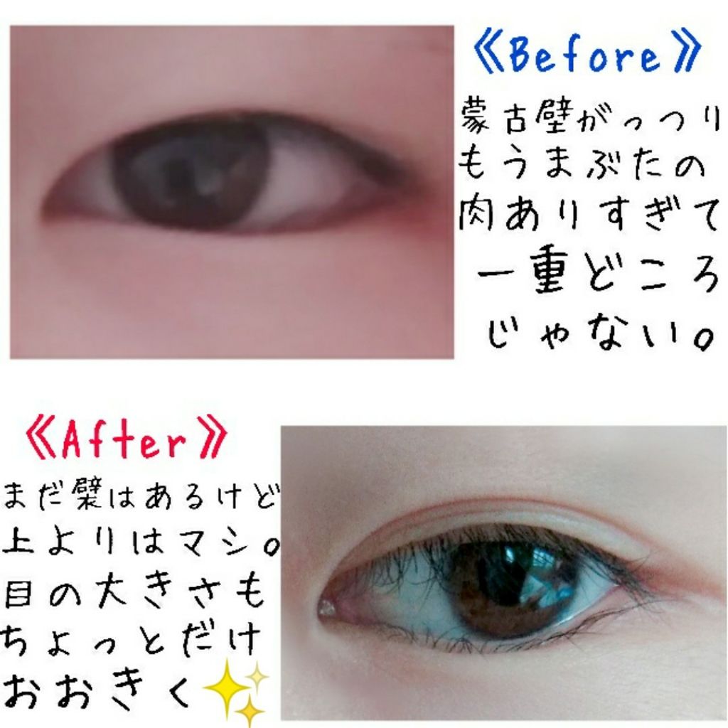 のびーるアイテープ(絆創膏タイプ、レギュラー)/DAISO/二重まぶた用アイテムを使ったクチコミ(2枚目)