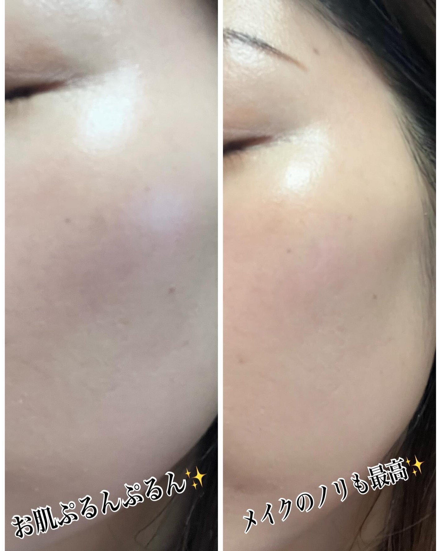 シャンティ on LIPS 「\世界中で愛されて、20億枚突破/\大人気パック/\肌荒れ予防..」(6枚目)