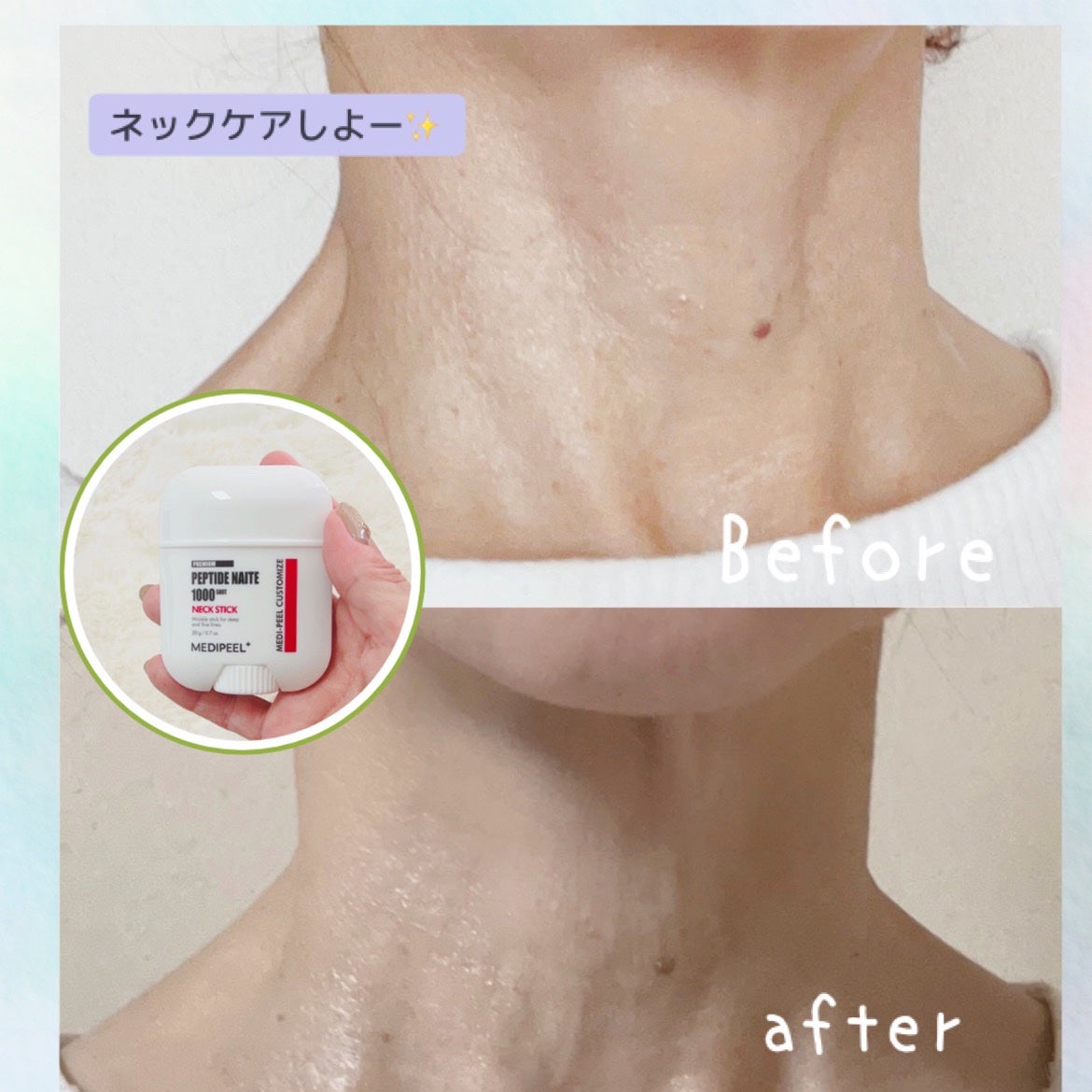 プレミアムナイテ スレッドネッククリーム/MEDIPEEL/ネック・デコルテケアを使ったクチコミ(3枚目)