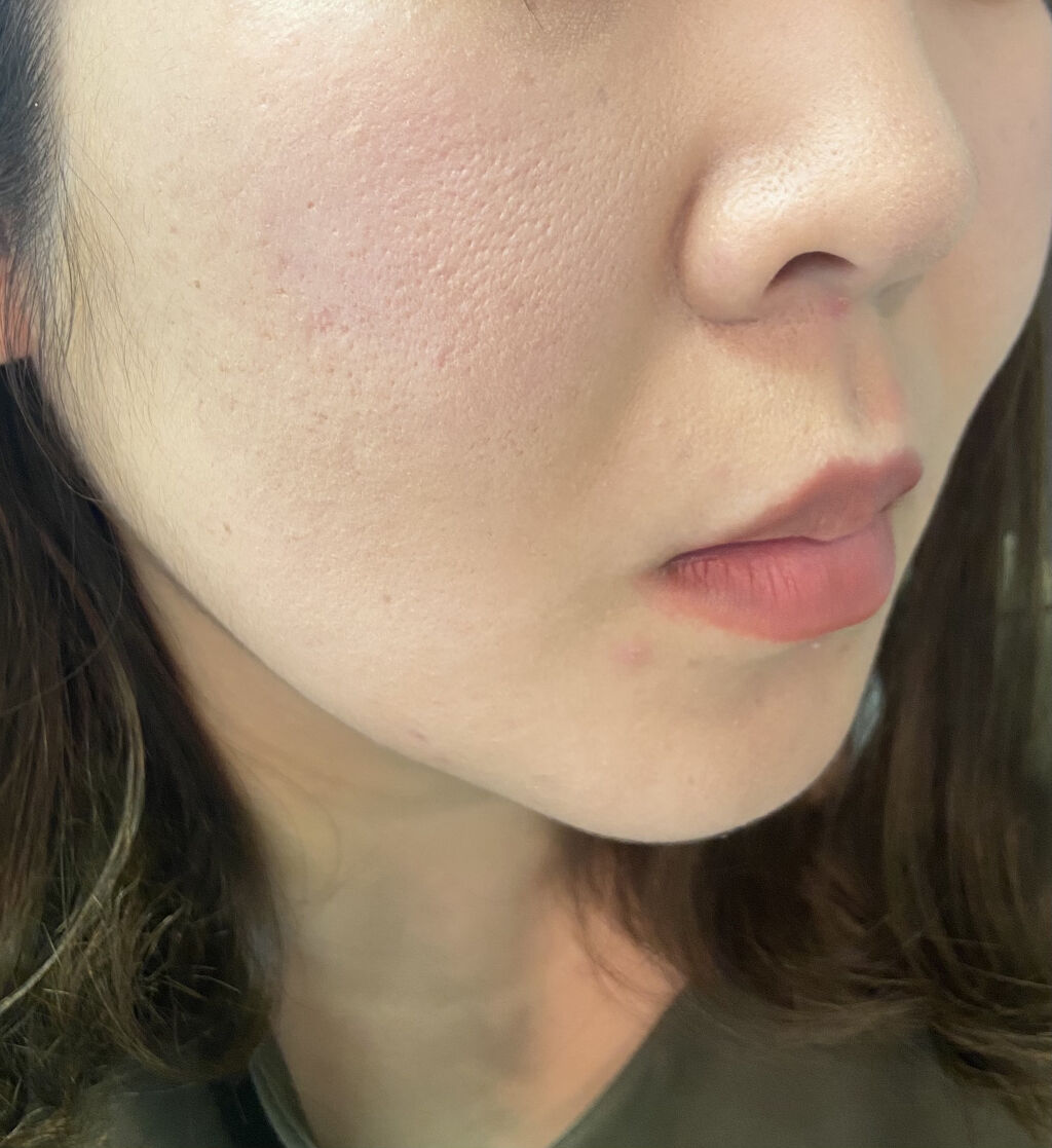 リアルカバーリキッド（ライトグロウ）/KATE/リキッドファンデーションを使ったクチコミ（2枚目）