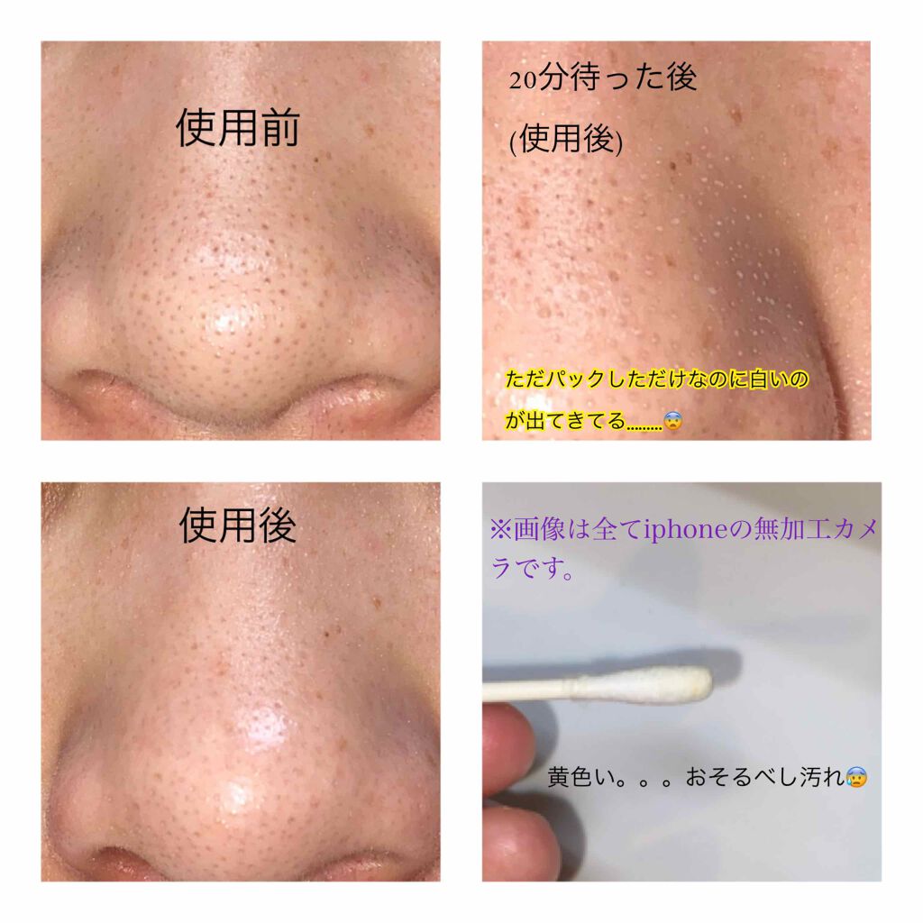 ノーモアブラックヘッド(ノーズピーリング)/One-day's you/スクラブ・ゴマージュを使ったクチコミ(2枚目)