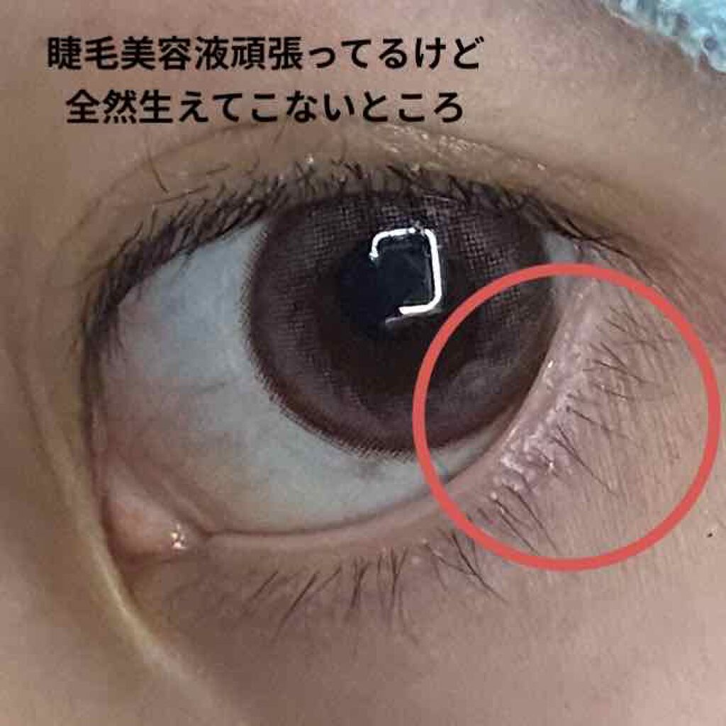 アイラッシュセラム/THE STEM CELL/まつげ美容液を使ったクチコミ(2枚目)
