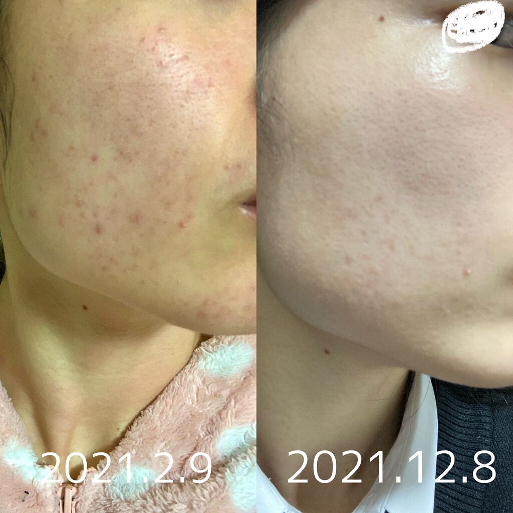 赤箱 (しっとり)/カウブランド/洗顔石鹸を使ったクチコミ(3枚目)