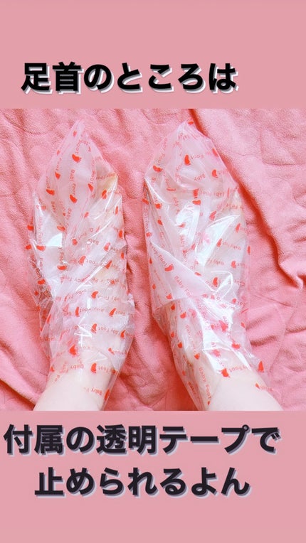 ベビーフット 重曹殺菌消毒洗浄剤/ベビーフット/レッグ・フットケアを使ったクチコミ(3枚目)