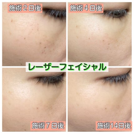 ベネフィーク セラム/BENEFIQUE/美容液を使ったクチコミ(2枚目)