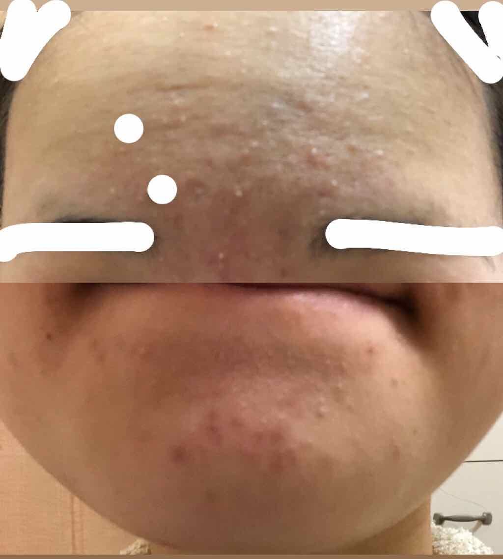 ドクタージャルト シカペアトナー/Dr.Jart＋/化粧水を使ったクチコミ（3枚目）